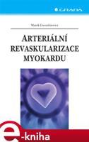 Arteriální revaskularizace myokardu - Marek Gwozdziewicz