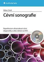 Cévní sonografie - Milan Cholt