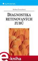 Diagnostika retinovaných zubů - Pavlína Černochová