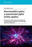 Neuromyelitis optica a poruchy jejího širšího spektra - kolektiv, Petra Nytrová