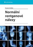 Normální rentgenové nálezy - Torsten B. Möller