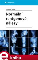 Normální rentgenové nálezy - Torsten B. Möller