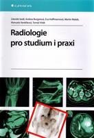 Radiologie pro studium i praxi - Zdeněk Seidl, Andrea Burgetová, Eva Hoffmannová, Martin Mašek, Manuela Vaněčková, Tomáš Viták