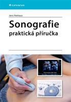 Sonografie - praktická příručka - Jens Niehaus