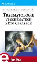 Traumatologie ve schématech a RTG obrazech - Ivo Žvák, Jan Brožík, Jaromír Kočí, Alexander Ferko